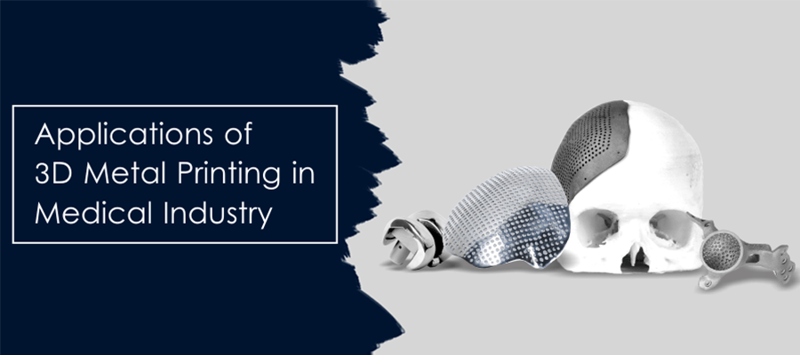 Metal Powders in Orthopedic Implants 1 Metal Powders In Orthopedic Implants